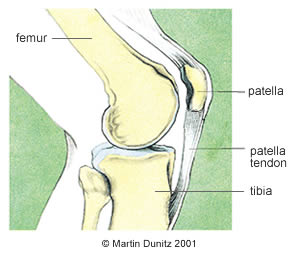 Knee Pain Under The Kneecap After Running
