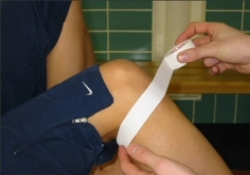 Patella Tendon Taping - Step 1