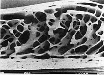 bone