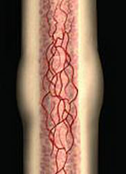 Bone Remodelling Stage