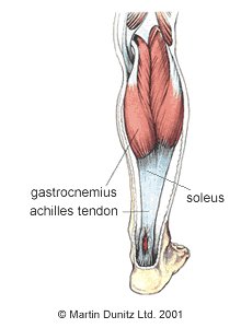 Achilles Tendonitis