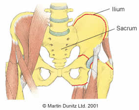 Sacro Iliac Joint Dysfunction