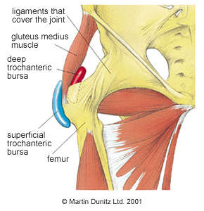 Trochanteric Bursitis and how Pilates & Rebounding helped me.