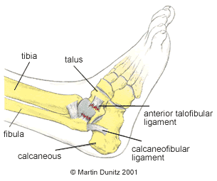 Anatomy of ankle sprain injury