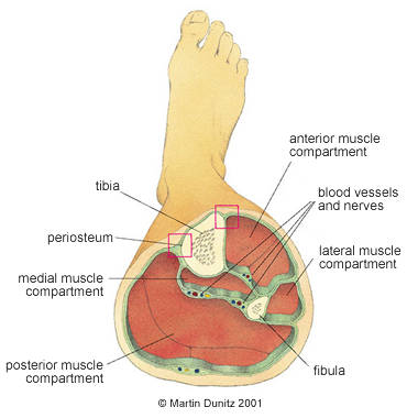 Anatomy of compartment syndrome