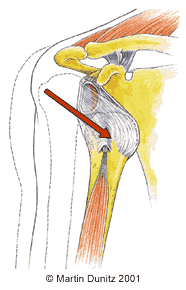 Anatomy of dislocated shoulder injury