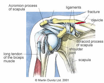 Anatomy of fractured collar bone injury
