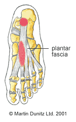 Anatomy of plantar facitis injury