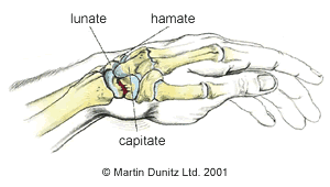 Anatomy of scaphoid fracture injury