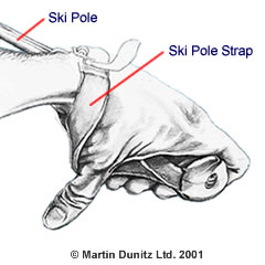 Diagram showing how ski poles can cause a thumb sprain