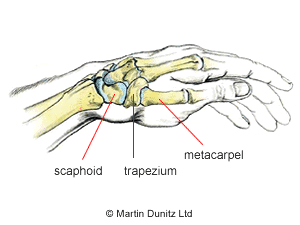 Photo: anatomy of wrist