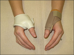 Photo: thumb joint splints