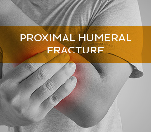 Proximal Humeral Fracture