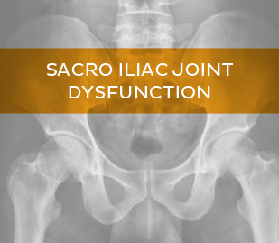 Sacro Iliac Joint Dysfunction