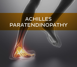 Achilles Paratendinopathy