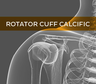 Rotator Cuff Calcific Tendonitis