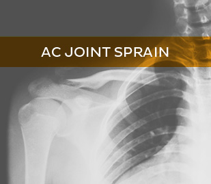 AC Joint Sprain