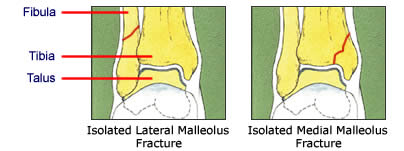 Ankle Joint - part 1