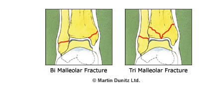Ankle Joint - part 1