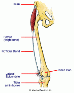 IT Band Syndrome/Knee Pain